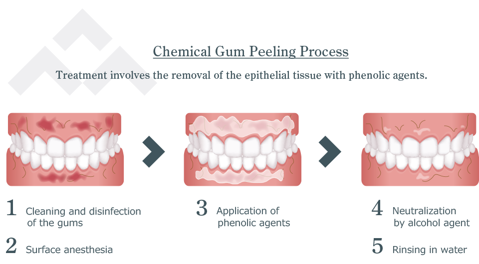 Gums Peeling